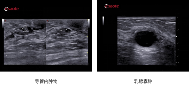 1、高分辨率的乳腺基础图像，为诊断提供信心.png